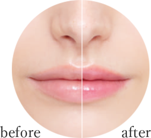 before / after